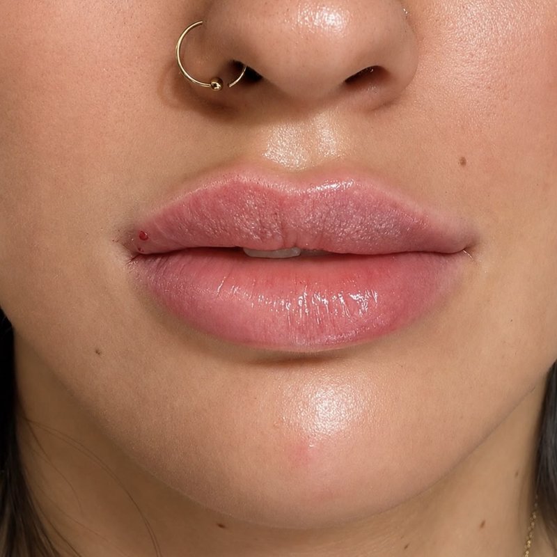 JS Aesthetics Beauty Lounge treatment result 1